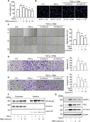 Photobiomodulation ameliorates inflammatory parameters in fibroblast-like synoviocytes and experimental animal models of rheumatoid arthritis